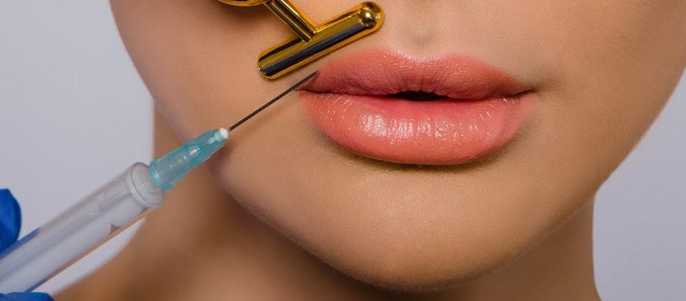 augmentation of the lips