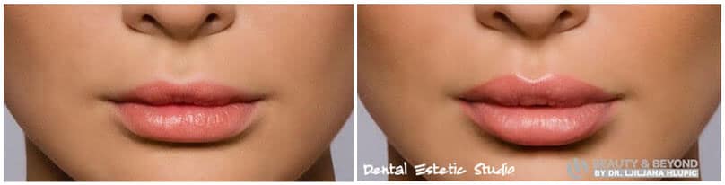facial aesthetics